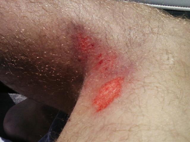 6-16-08 ouch (Small).jpg