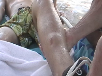 Broken Leg.jpg