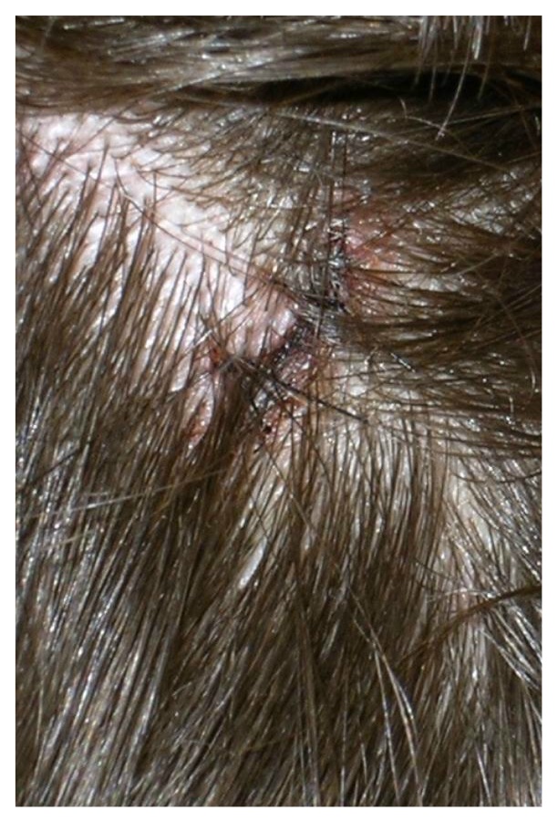 cutinhead.JPG